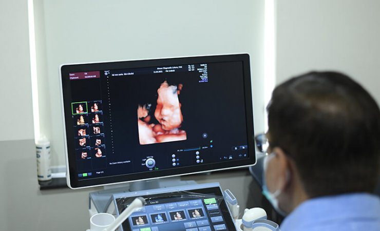 best 3D and 4D ultrasound in lahore