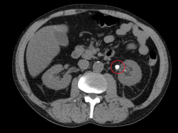 Best CT Kub scan in lahore