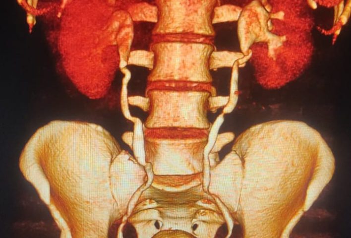 Best Ct Kub scan in lahore