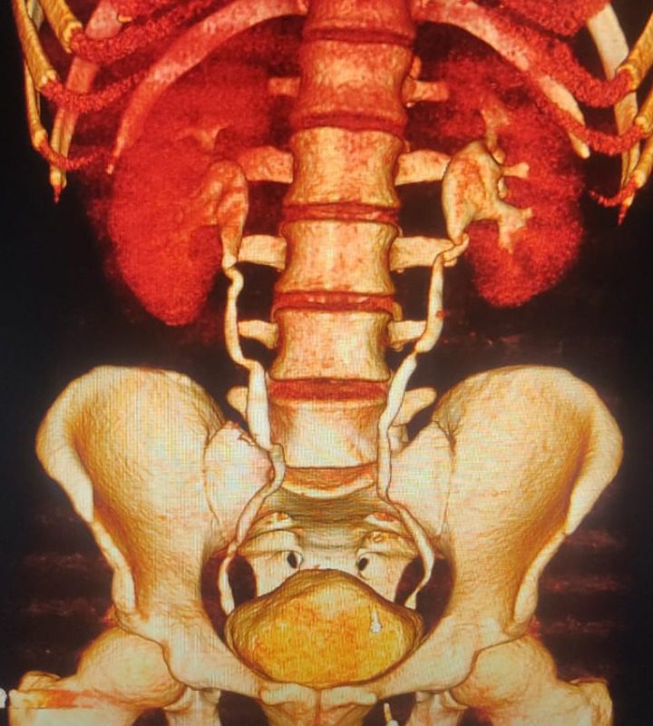 Best Ct Kub scan in lahore