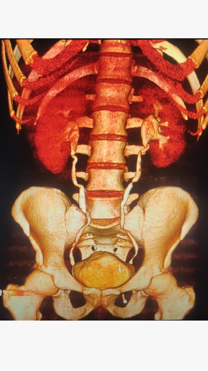 Best Ct Kub scan in lahore