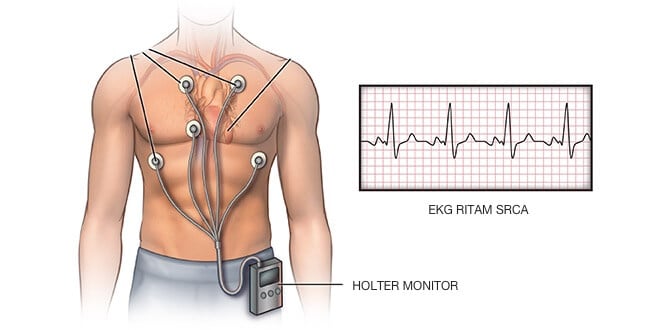 R4 Holter Monitoring in lahore