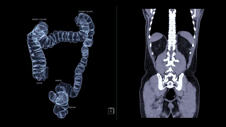 CT colonography in lahore